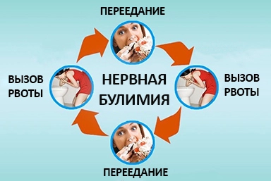 Лечение булимии в Киселёвске